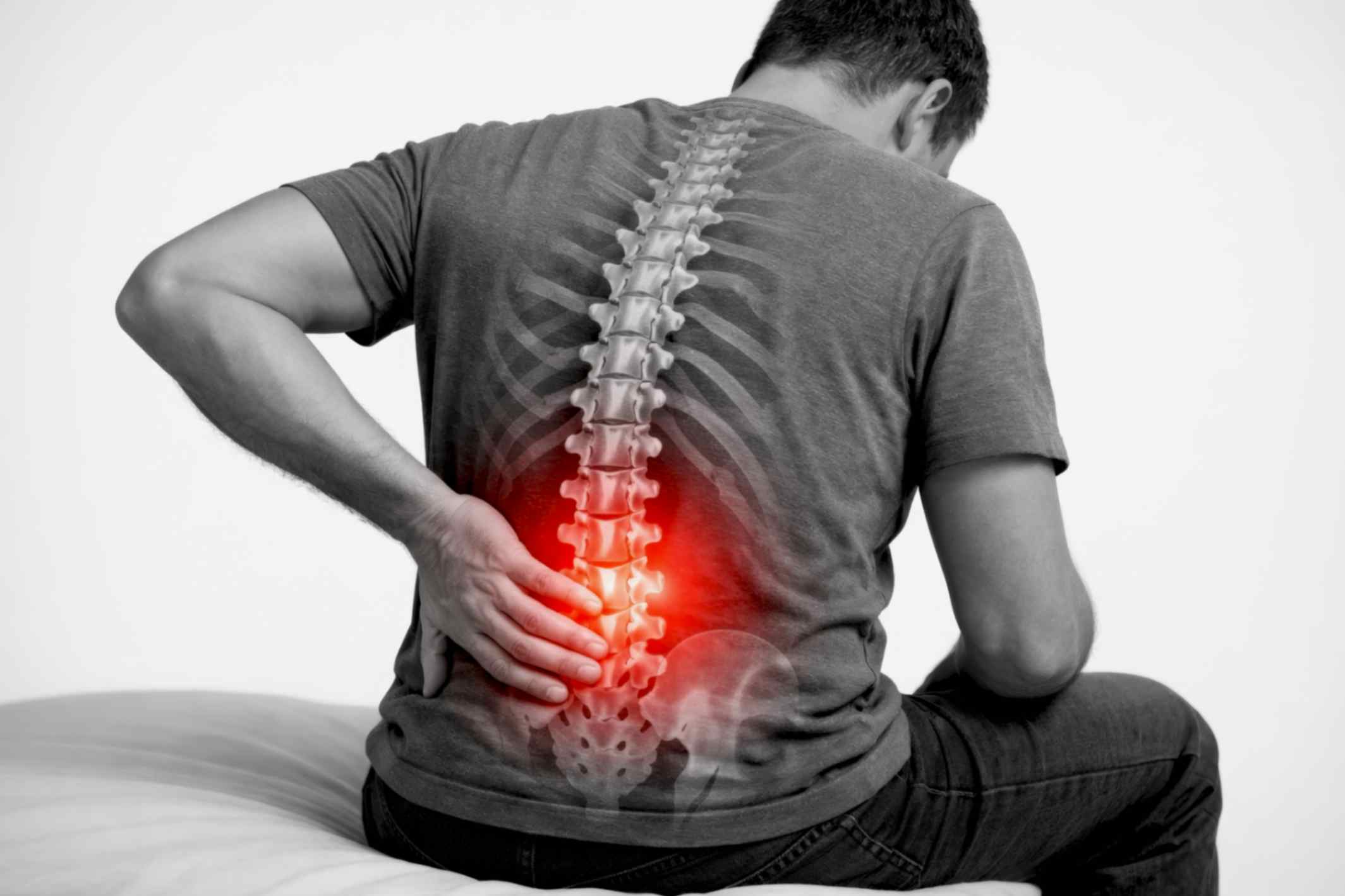 Spine anatomy and disc herniation
