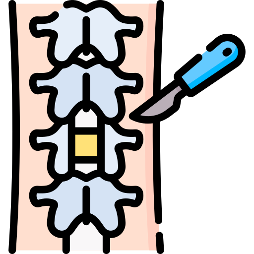 laminectomy_8670745